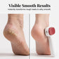 ⏳🔥LIMITED-TIME 50% OFF! ⏰Double-Sided Foot Scraper for Callus Removal